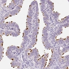 Immunohistochemical staining of human Fallopian tube shows strong positivity in cilia in glandular cells.
