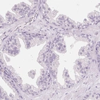 Immunohistochemical staining of human prostate shows no positivity in glandular cells as expected.