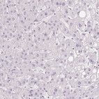 Immunohistochemical staining of human liver shows no positivity in hepatocytes as expected.
