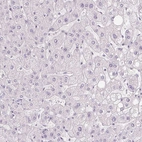 Immunohistochemical staining of human liver shows no positivity in hepatocytes as expected.