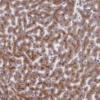 Immunohistochemical staining of human liver shows strong cytoplasmic granular positivity in hepatocytes.