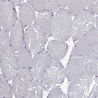 Immunohistochemical staining of human skeletal muscle shows no positivity in myocytes as expected.