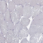 Immunohistochemical staining of human skeletal muscle shows no positivity in myocytes as expected.