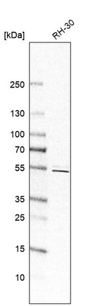 Western blot analysis in human cell line RH-30.