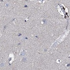 Immunohistochemical staining of human cerebral cortex using Anti-ACY3 antibody HPA039219.