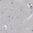 Immunohistochemical staining of human cerebral cortex using Anti-ACY3 antibody HPA039219.