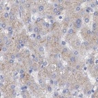 Immunohistochemical staining of human liver using Anti-ACY3 antibody HPA039219.