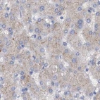 Immunohistochemical staining of human liver using Anti-ACY3 antibody HPA039219.
