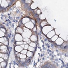 Immunohistochemical staining of human colon using Anti-ACY3 antibody HPA039219.