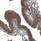 Immunohistochemical staining of human fallopian tube shows strong cytoplasmic positivity in glandular cells.