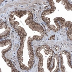 Immunohistochemical staining of human prostate shows strong cytoplasmic positivity in glandular cells.