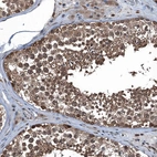 Immunohistochemical staining of human testis shows strong cytoplasmic positivity in cells in seminiferous ducts.