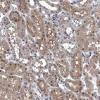 Immunohistochemical staining of human kidney shows moderate cytoplasmic positivity in cells in tubules.