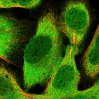 Immunofluorescent staining of human cell line U-2 OS shows localization to nucleoplasm & cytosol.