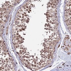 Anti-RBMS2 Antibody
