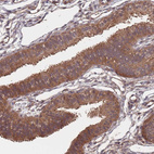 Immunohistochemical staining of human Fallopian tube shows strong cytoplasmic positivity in glandular cells.