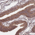 Immunohistochemical staining of human Fallopian tube shows strong cytoplasmic positivity in glandular cells.