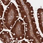 Immunohistochemical staining of human Small intestine shows strong cytoplasmic positivity in glandular cells.