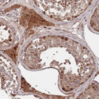 Immunohistochemical staining of human Testis shows moderate nuclear and cytoplasmic positivity in cells in seminiferous ducts and Leydig cells.