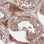 Immunohistochemical staining of human Testis shows moderate nuclear and cytoplasmic positivity in cells in seminiferous ducts and Leydig cells.