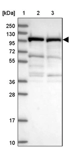Lane 1: Marker [kDa] 250, 130, 95, 72, 55, 36, 28, 17, 10_br/_Lane 2: Human cell line RT-4_br/_Lane 3: Human cell line U-251MG sp