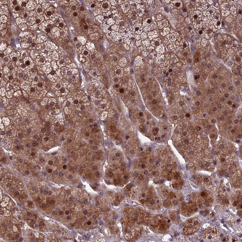 Anti-KLHL35 Antibody