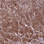 Anti-KLHL35 Antibody