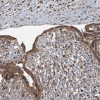 Immunohistochemical staining of human placenta shows moderate cytoplasmic positivity in trophoblastic cells.