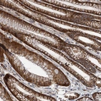 Immunohistochemical staining of human stomach shows strong cytoplasmic-membranous positivity in glandular cells.