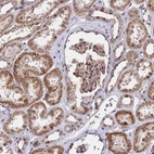 Anti-ZC3H10 Antibody