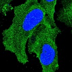 Immunofluorescent staining of human cell line U-2 OS shows localization to plasma membrane & cytosol.