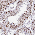 Anti-BANF1 Antibody