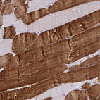 Immunohistochemical staining of human skeletal muscle shows strong cytoplasmic positivity in myocytes.