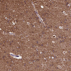 Anti-TUBA1A Antibody