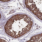 Immunohistochemical staining of human testis shows strong cytoplasmic positivity in cells in seminiferous ducts.