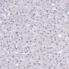 Immunohistochemical staining of human liver shows low positivity in hepatocytes as expected.