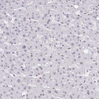 Immunohistochemical staining of human liver shows low positivity in hepatocytes as expected.