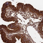 Immunohistochemical staining of human fallopian tube shows strong cytoplasmic positivity in glandular cells.