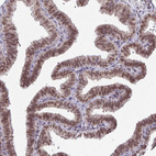 Anti-BANF1 Antibody