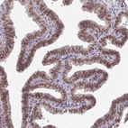 Immunohistochemical staining of human Fallopian tube shows strong nuclear positivity in glandular cells.