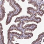 Immunohistochemical staining of human Fallopian tube shows strong nuclear positivity in glandular cells.