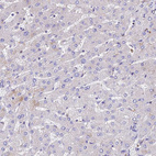 Immunohistochemical staining of human liver shows no positivity in hepatocytes as expected.