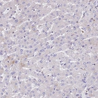 Immunohistochemical staining of human liver shows no positivity in hepatocytes as expected.