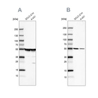 Anti-TUBA1A Antibody