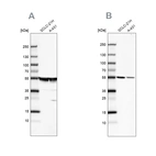 Western blot analysis using Anti-TUBA1A antibody HPA039247 (A) shows similar pattern to independent antibody HPA043684 (B).
