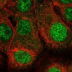 Immunofluorescent staining of human cell line MCF7 shows localization to nucleoplasm.