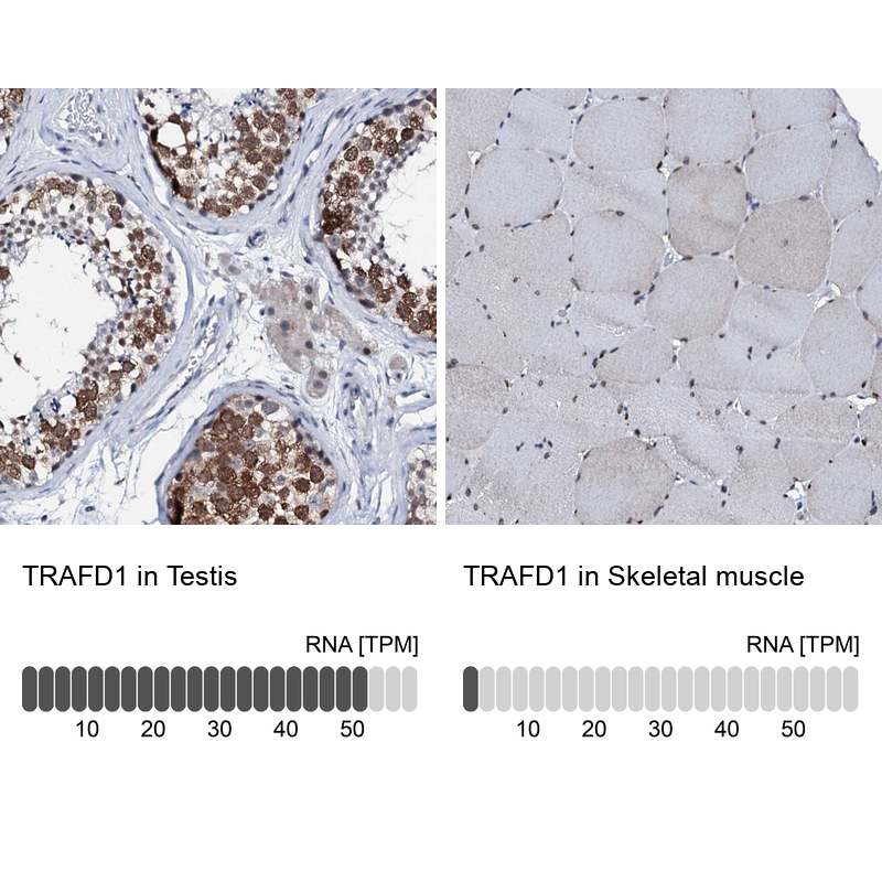 Anti-TRAFD1 Antibody