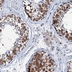 Immunohistochemical staining of human testis shows high expression.