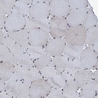 Immunohistochemical staining of human skeletal muscle shows low expression as expected.