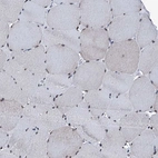 Immunohistochemical staining of human skeletal muscle shows low expression as expected.